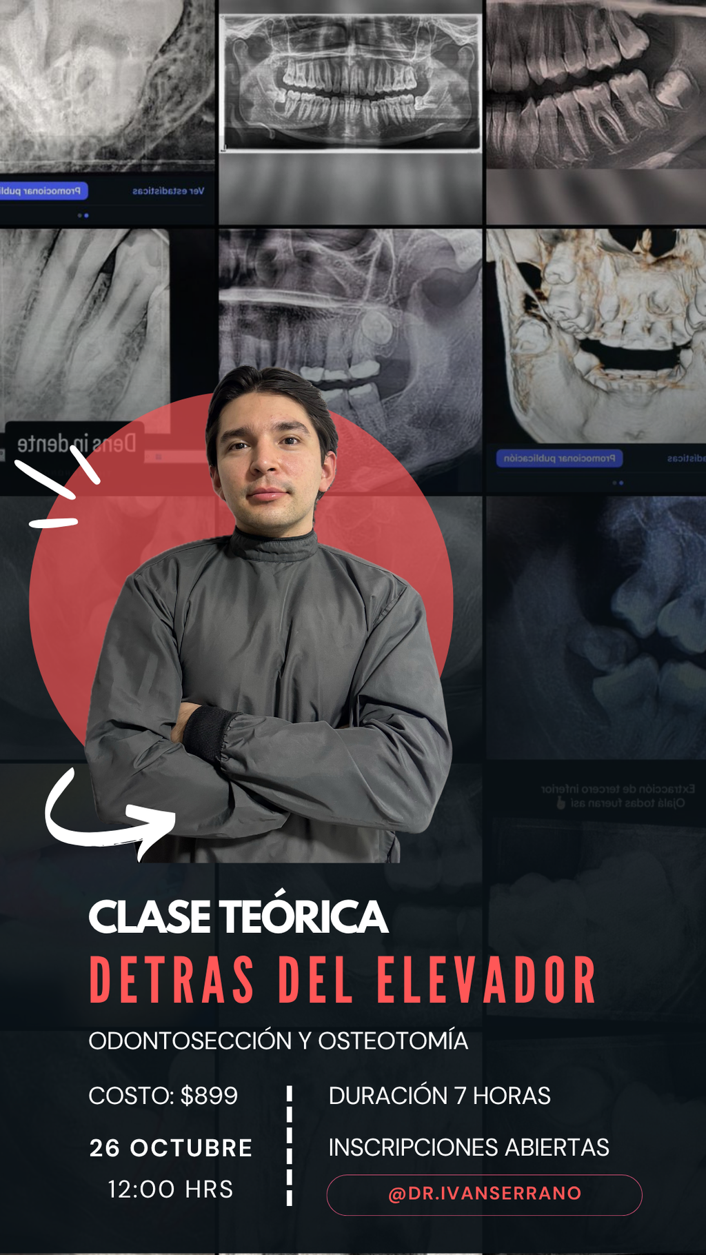 Detrás del Elevador Teórico